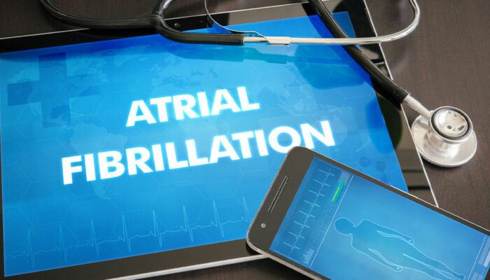Atrial fibrillation – Causes, symptoms, and management tips