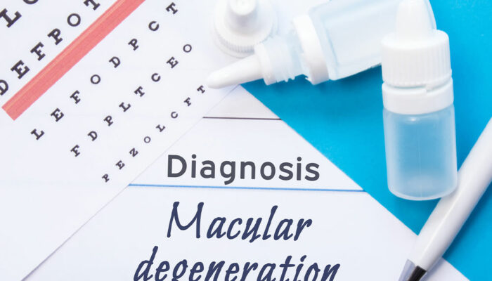 Key facts about age-related macular degeneration