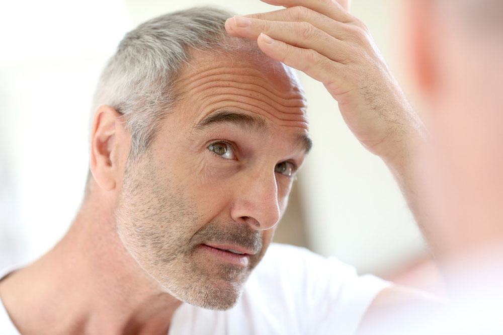 Hair loss – Types, causes, and foods that promote healthy growth